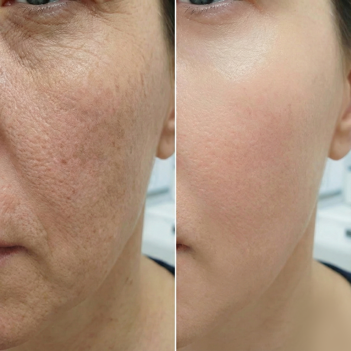 Miradia™ Baume Lift & Éclat Naturel